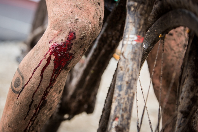 koleno krvavé. brrr